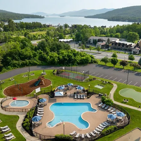 Holiday Inn Resort Lake George - Adirondack Area By Ihg-3
